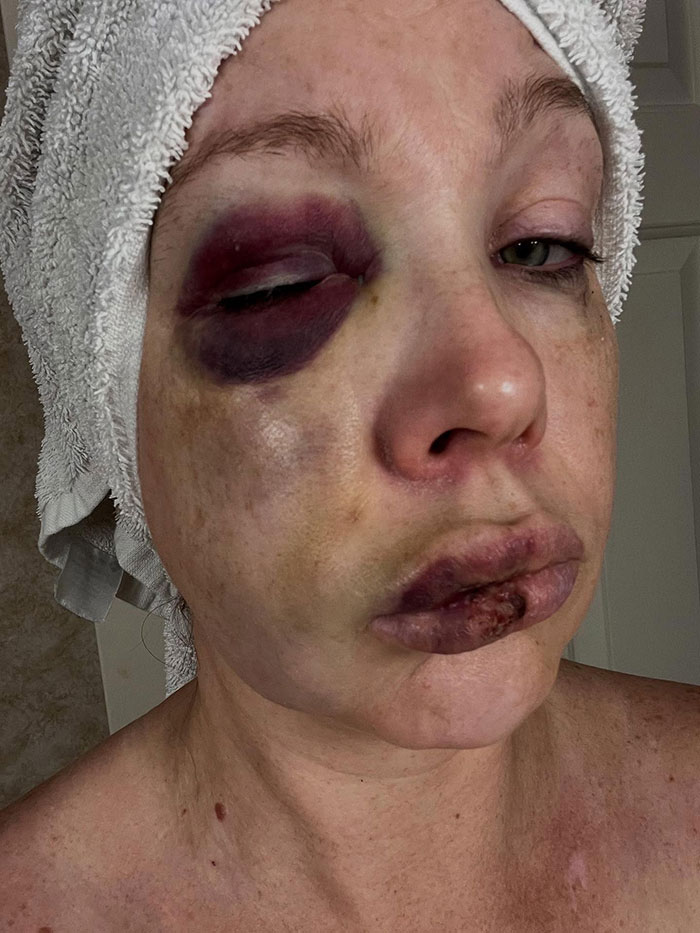 &#8220;The City Of Cincinnati Should Be Ashamed&#8221;: Mass Support For Woman Beaten After New Interview