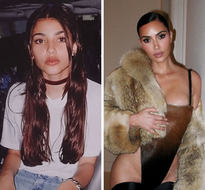 Kim Kardashian Travels To Mexico For Procedure Unavailable In US, Shares Surgery Room Pics