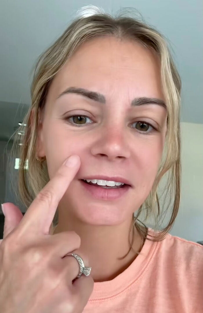 Mom Ends Up in Urgent Care After Popping Pimple In The “Triangle Of Death”