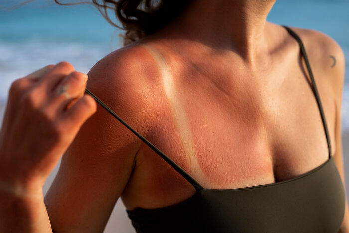 32 Excuses People Used To Call Off Work That Sound Made Up—But Are Actually True