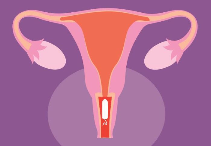 This Woman Accidentally Left A Tampon Inside Her For A Month—She&#8217;s Now Sharing Her &#8216;Traumatizing&#8217; Story
