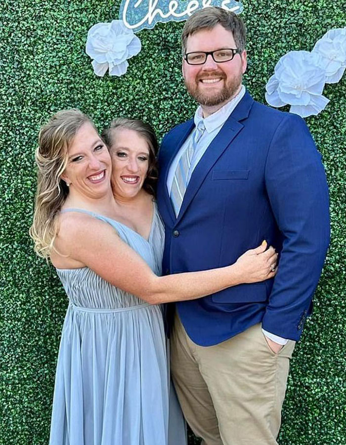 TLC’s Abby &#038; Brittany Hensel Resurface—This Time With A Baby