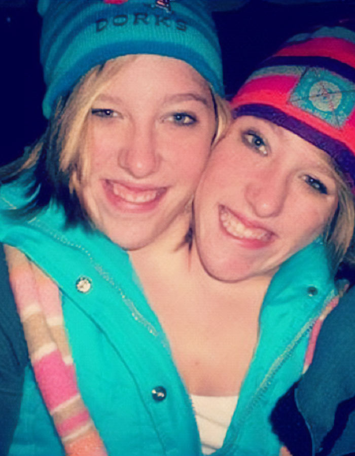 TLC’s Abby &#038; Brittany Hensel Resurface—This Time With A Baby