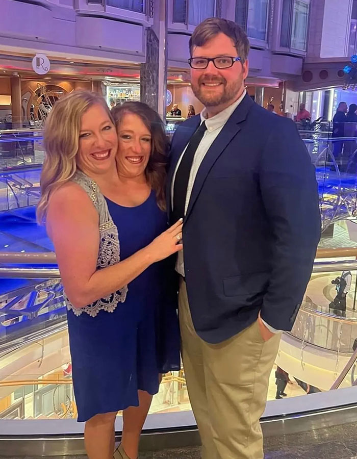 TLC’s Abby &#038; Brittany Hensel Resurface—This Time With A Baby