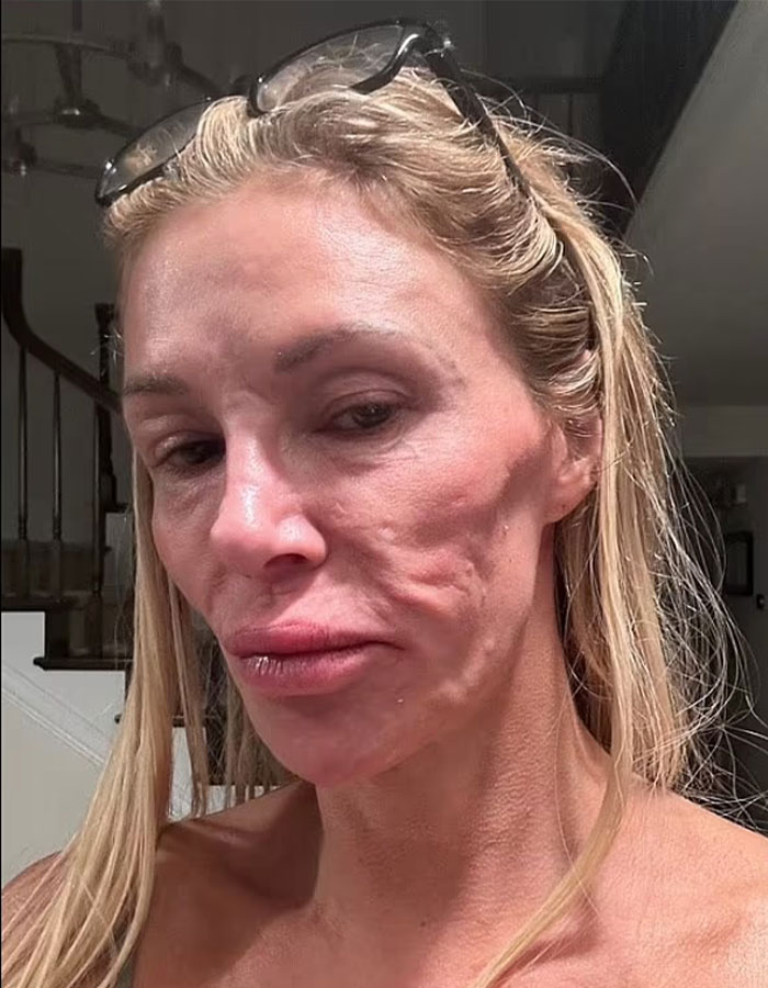 Brandi Glanville Reveals New Smile After $130K Health Battle And Face-Disfiguring Parasite