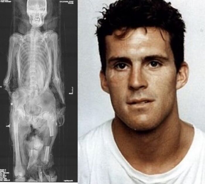 100 Unsettling Images From The &#8220;Morbid Knowledge&#8221; Online Group