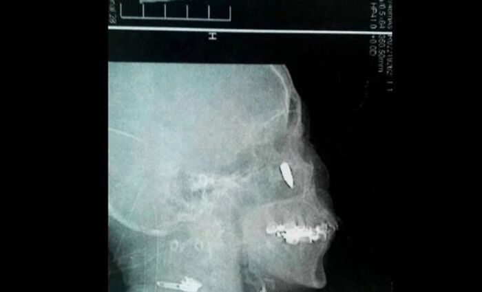 100 Unsettling Images From The &#8220;Morbid Knowledge&#8221; Online Group
