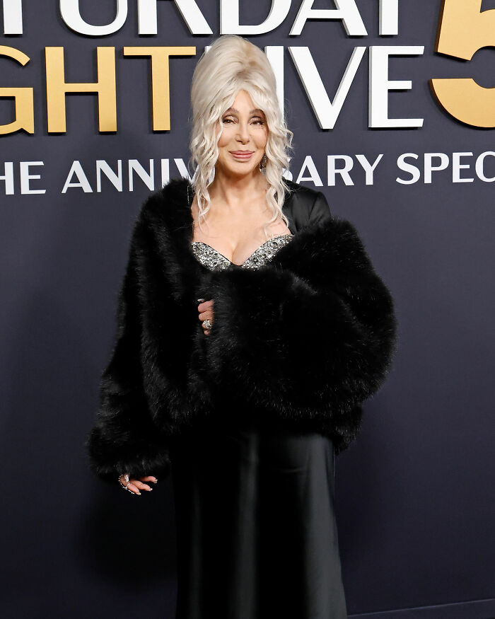Cher&#8217;s &#8216;Melting&#8217; Appearance Sparks Concern As Her Friends Break Silence On Her Plastic Surgery &#8216;Indulgence&#8217;