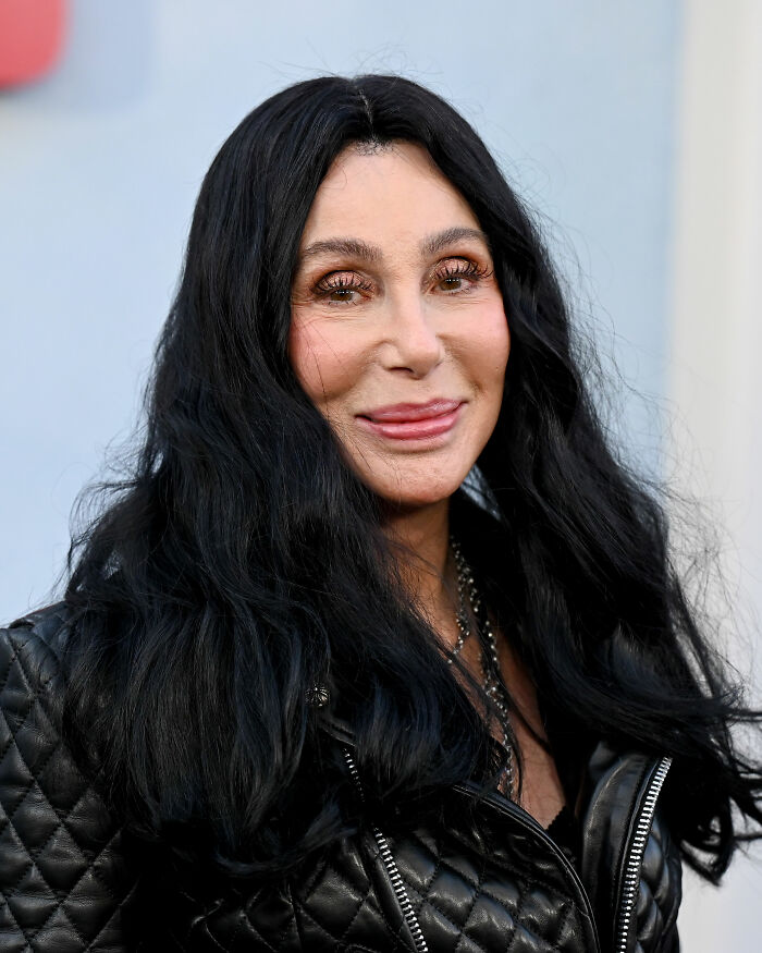 Cher&#8217;s &#8216;Melting&#8217; Appearance Sparks Concern As Her Friends Break Silence On Her Plastic Surgery &#8216;Indulgence&#8217;