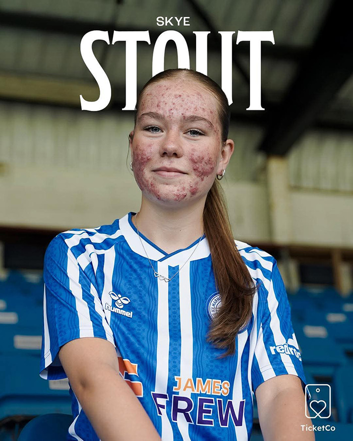 16YO Footballer Heartlessly Bullied For Her Looks Shuts Down &#8216;Pathetic&#8217; Trolls With Fantastic Response