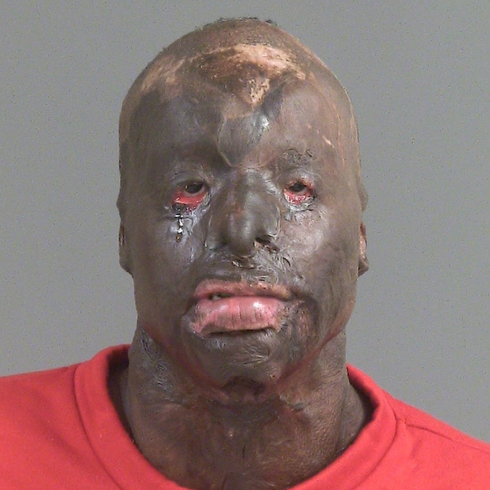 17-Year-Old Fatally Shot, Main Suspect Turns Himself In But His Appearance Stuns People