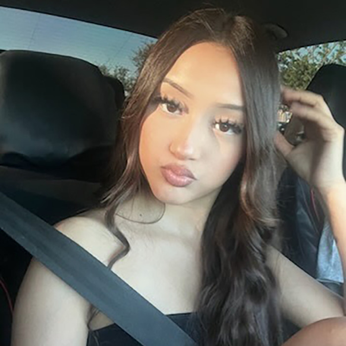 Teen Daughter&#8217;s Heartbreaking Question To Mom After Being Mauled By Pack Of Dogs