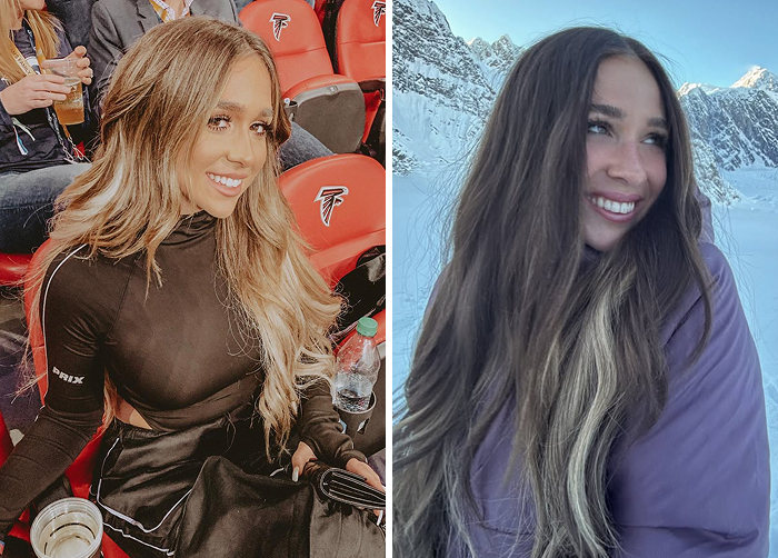 15 Before-And-After Photos Of Celebs Who Replaced Regular Botox With “Lip Flip” For A New Kind Of Look