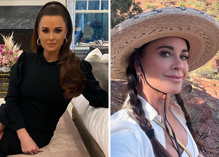15 Before-And-After Photos Of Celebs Who Replaced Regular Botox With “Lip Flip” For A New Kind Of Look