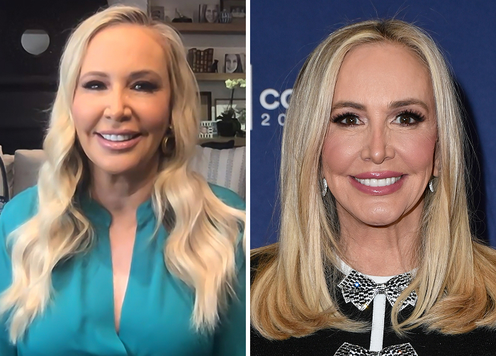 15 Before-And-After Photos Of Celebs Who Replaced Regular Botox With “Lip Flip” For A New Kind Of Look