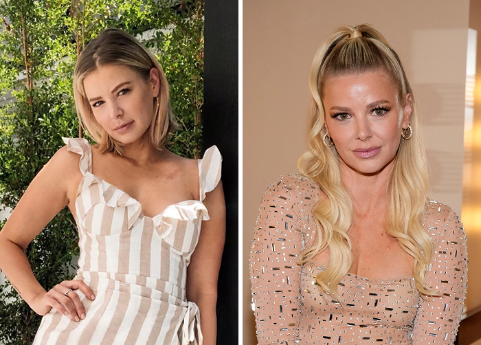 15 Before-And-After Photos Of Celebs Who Replaced Regular Botox With “Lip Flip” For A New Kind Of Look
