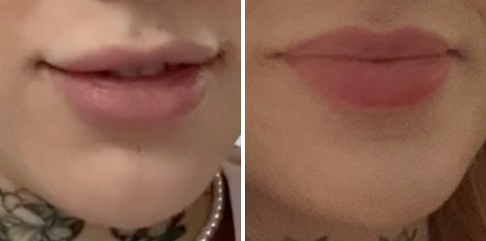 15 Before-And-After Photos Of Celebs Who Replaced Regular Botox With “Lip Flip” For A New Kind Of Look
