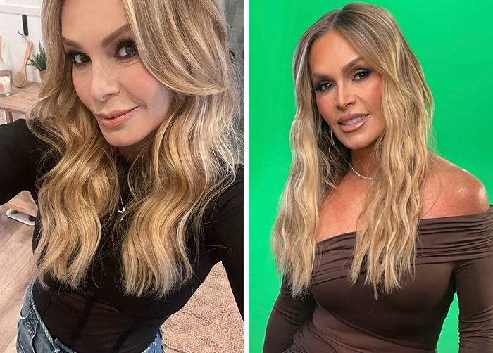 15 Before-And-After Photos Of Celebs Who Replaced Regular Botox With “Lip Flip” For A New Kind Of Look