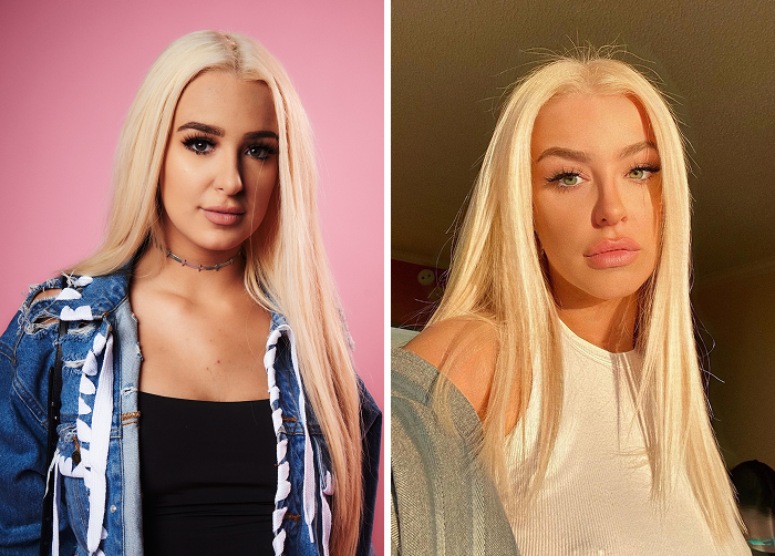 15 Before-And-After Photos Of Celebs Who Replaced Regular Botox With “Lip Flip” For A New Kind Of Look