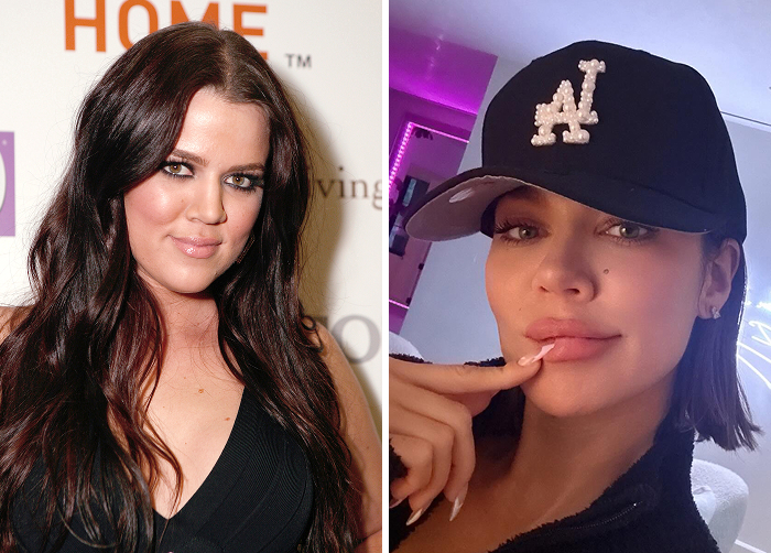 15 Before-And-After Photos Of Celebs Who Replaced Regular Botox With “Lip Flip” For A New Kind Of Look