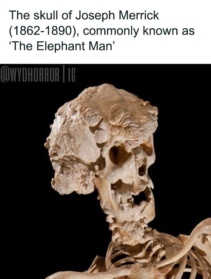 124 Random Creepy Facts And Pics To Deprive Somebody Of Sleep
