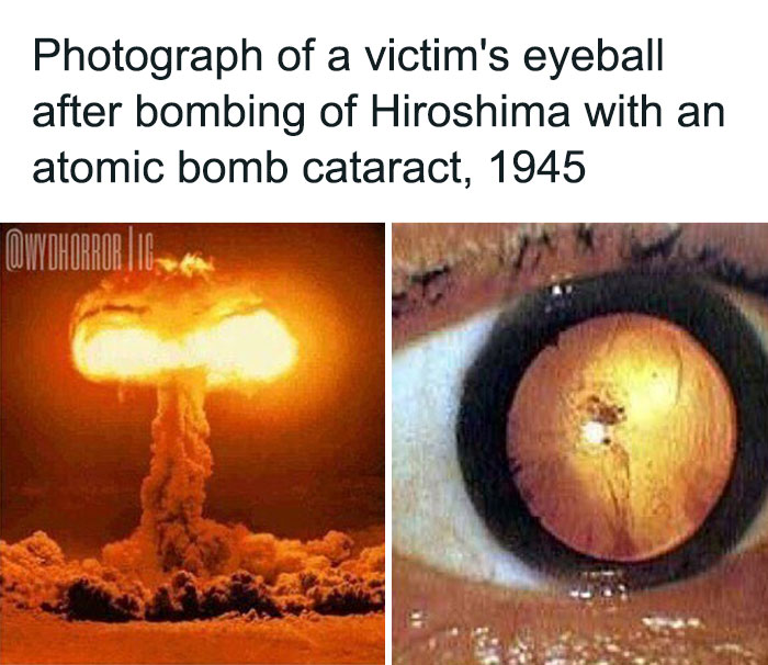 124 Random Creepy Facts And Pics To Deprive Somebody Of Sleep