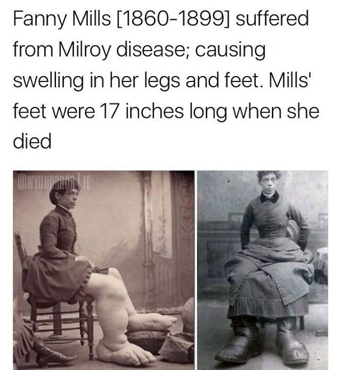 124 Random Creepy Facts And Pics To Deprive Somebody Of Sleep