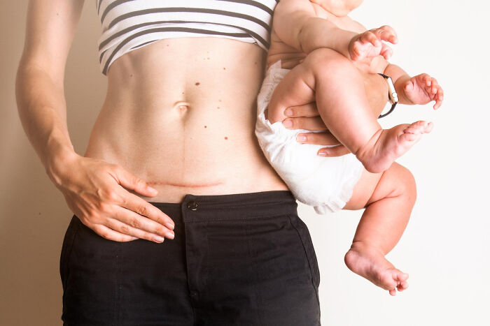 27 Examples Of Everyday Sexism And Pressure Women Were Conditioned To Accept As Normal