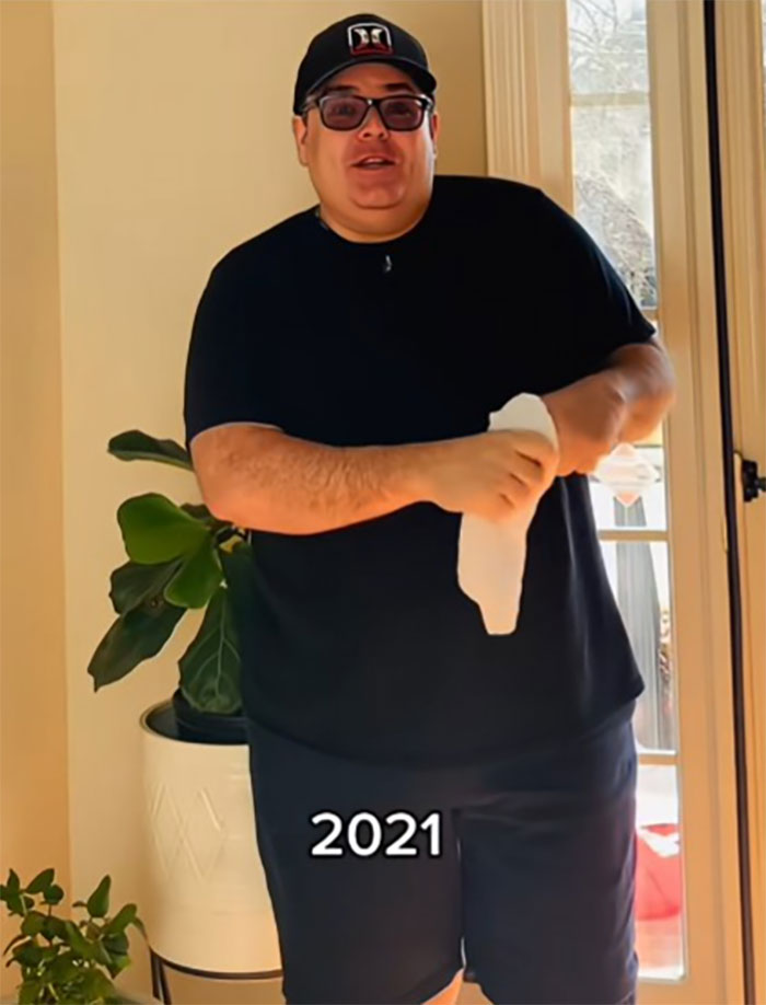 This Man Went To Mexico For A Facelift And Almost Broke The Internet With His Big Reveal