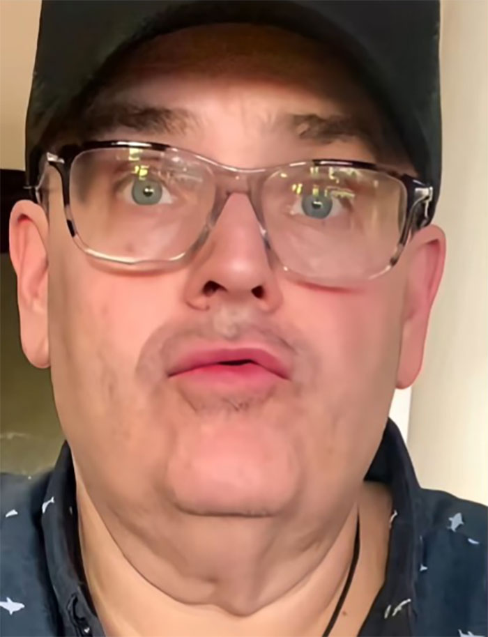 This Man Went To Mexico For A Facelift And Almost Broke The Internet With His Big Reveal