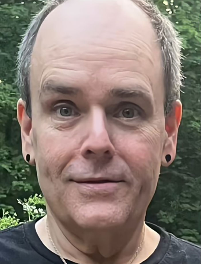 This Man Went To Mexico For A Facelift And Almost Broke The Internet With His Big Reveal