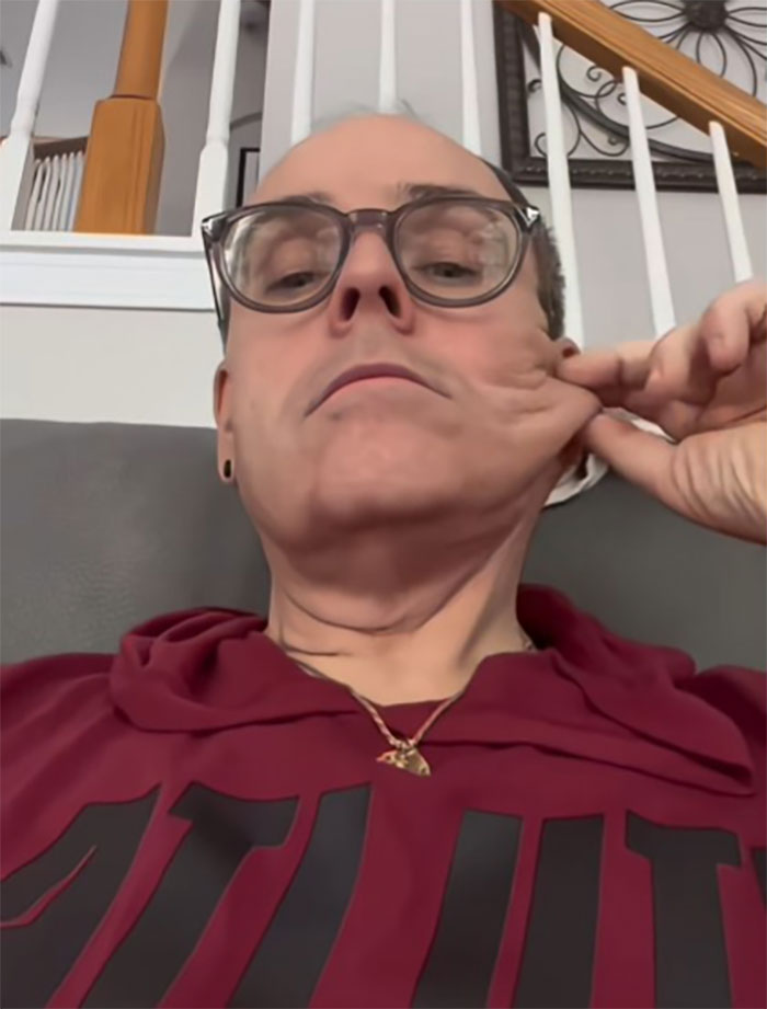 This Man Went To Mexico For A Facelift And Almost Broke The Internet With His Big Reveal