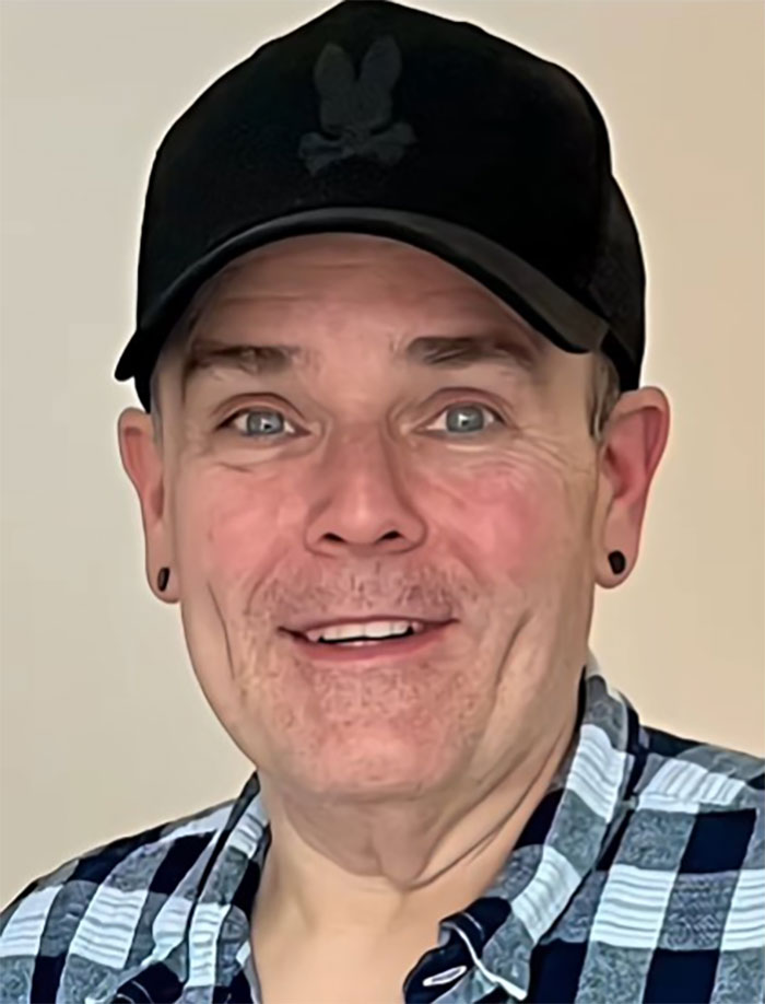 This Man Went To Mexico For A Facelift And Almost Broke The Internet With His Big Reveal