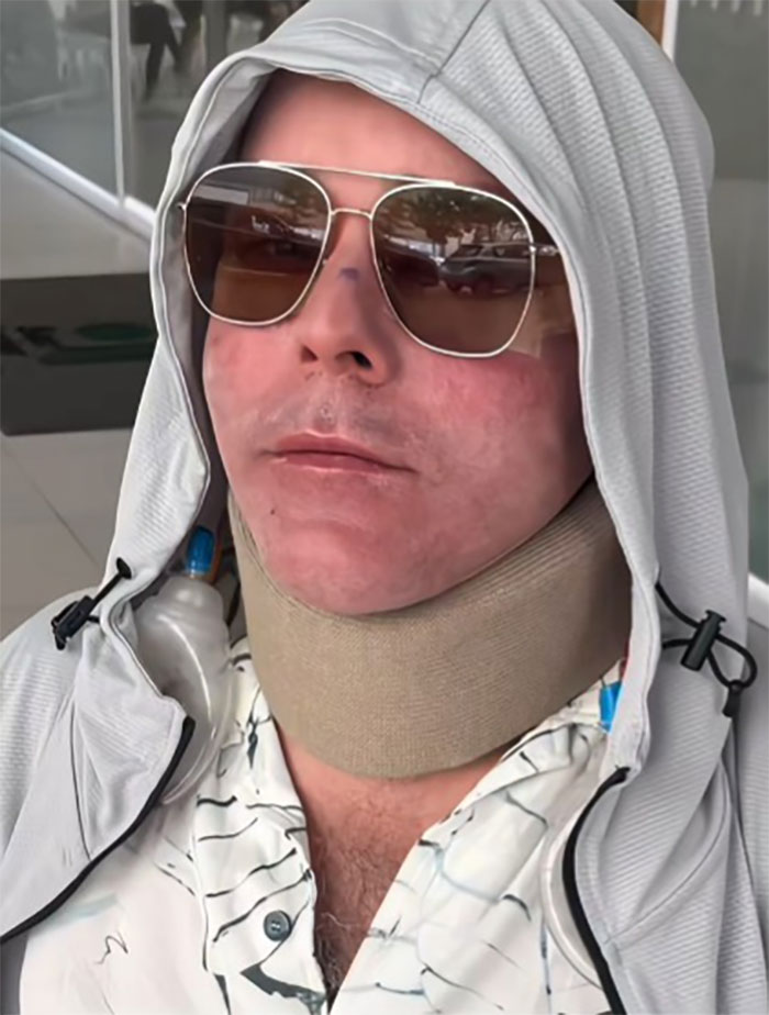 This Man Went To Mexico For A Facelift And Almost Broke The Internet With His Big Reveal