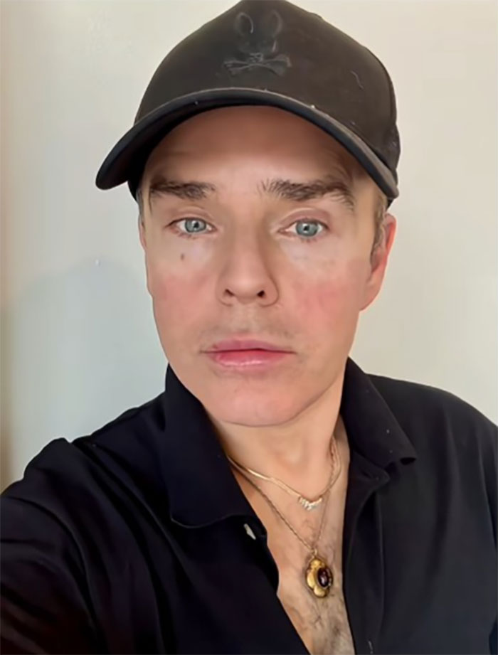 This Man Went To Mexico For A Facelift And Almost Broke The Internet With His Big Reveal