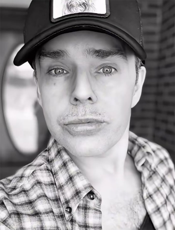 This Man Went To Mexico For A Facelift And Almost Broke The Internet With His Big Reveal