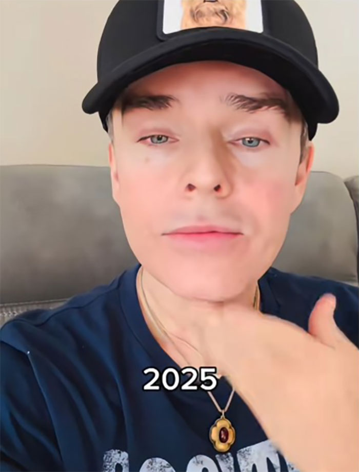 This Man Went To Mexico For A Facelift And Almost Broke The Internet With His Big Reveal