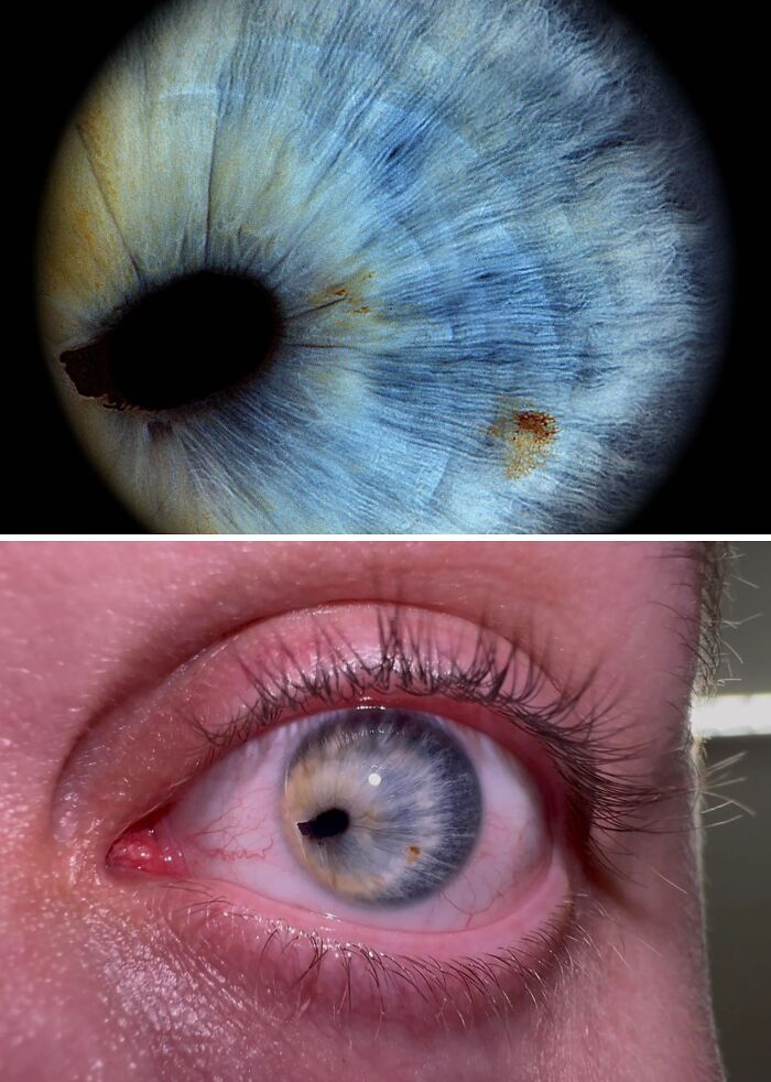 &#8220;My Extra Finger&#8221;: 85 Fascinating And Wild Things That Can Happen To The Human Body (New Pics)