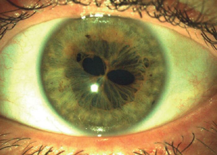&#8220;My Extra Finger&#8221;: 85 Fascinating And Wild Things That Can Happen To The Human Body (New Pics)