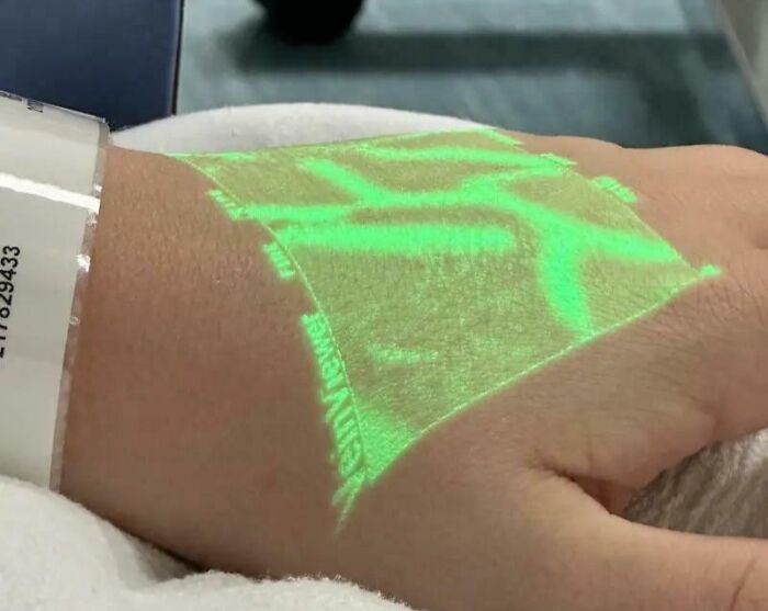 &#8220;My Extra Finger&#8221;: 85 Fascinating And Wild Things That Can Happen To The Human Body (New Pics)