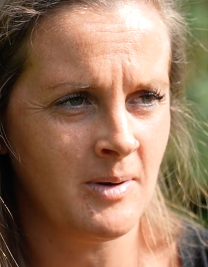 “It Felt Like An Axe”: Doctors Dismissed Her Pain For Years Until Scans Revealed Rare Disorder