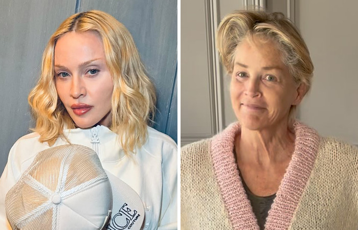 20 Side-By-Sides Of Celebrities That Show The Impact Of Plastic Surgery, Including Nicole Kidman