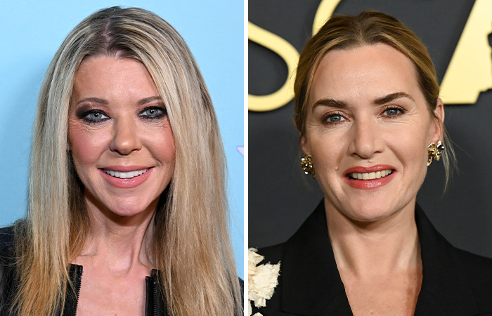 20 Side-By-Sides Of Celebrities That Show The Impact Of Plastic Surgery, Including Nicole Kidman