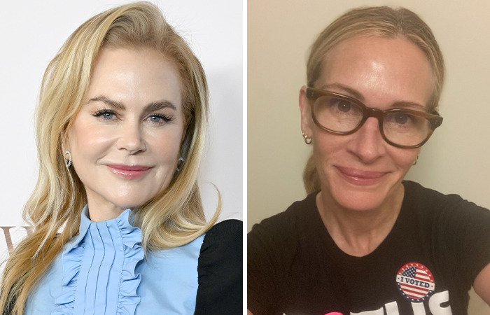 20 Side-By-Sides Of Celebrities That Show The Impact Of Plastic Surgery, Including Nicole Kidman