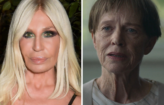 20 Side-By-Sides Of Celebrities That Show The Impact Of Plastic Surgery, Including Nicole Kidman