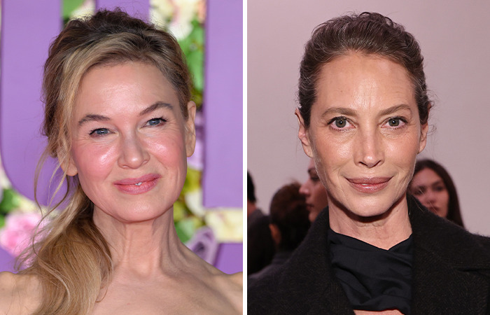 20 Side-By-Sides Of Celebrities That Show The Impact Of Plastic Surgery, Including Nicole Kidman