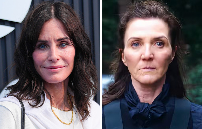 20 Side-By-Sides Of Celebrities That Show The Impact Of Plastic Surgery, Including Nicole Kidman