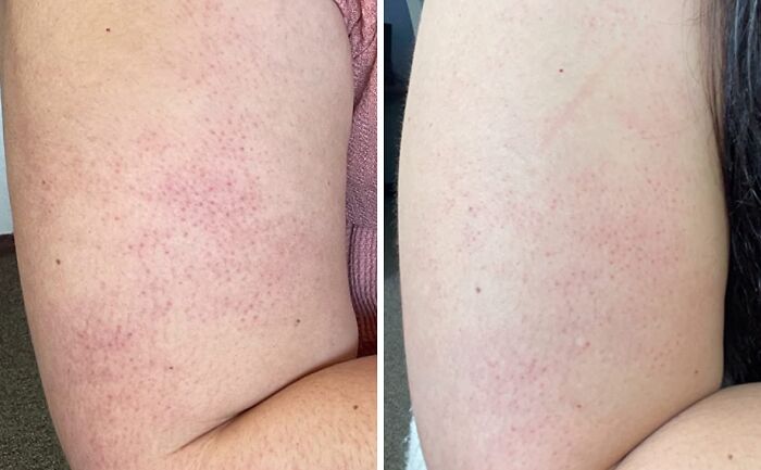 19 Things That Are A Little Awkward To Buy But A Huge Relief To Own