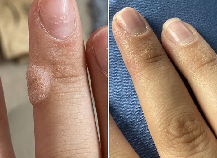19 Things That Are A Little Awkward To Buy But A Huge Relief To Own