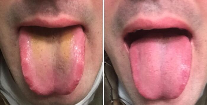 19 Things That Are A Little Awkward To Buy But A Huge Relief To Own